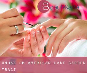Unhas em American Lake Garden Tract
