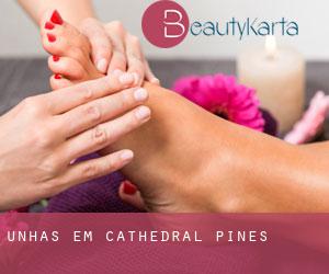 Unhas em Cathedral Pines