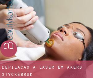 Depilação a laser em Åkers Styckebruk