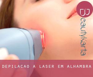 Depilação a laser em Alhambra