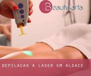 Depilação a laser em Alsace