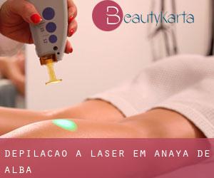 Depilação a laser em Anaya de Alba