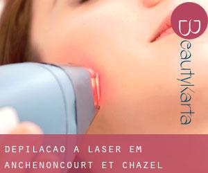 Depilação a laser em Anchenoncourt-et-Chazel
