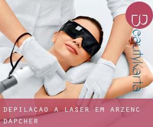 Depilação a laser em Arzenc-d'Apcher