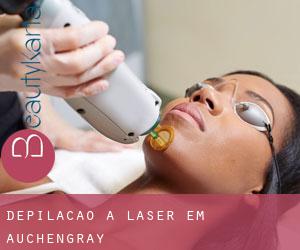 Depilação a laser em Auchengray