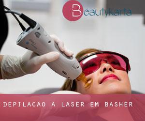 Depilação a laser em Basher
