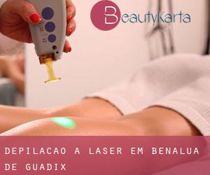 Depilação a laser em Benalúa de Guadix