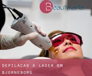 Depilação a laser em Björneborg