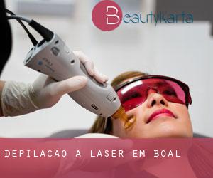 Depilação a laser em Boal