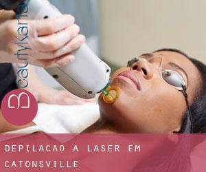 Depilação a laser em Catonsville