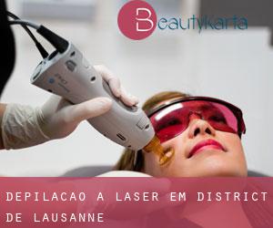 Depilação a laser em District de Lausanne