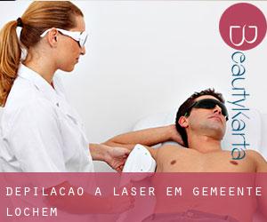 Depilação a laser em Gemeente Lochem