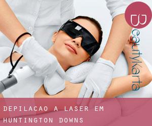 Depilação a laser em Huntington Downs