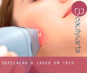 Depilação a laser em Iris