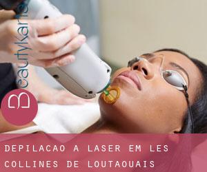 Depilação a laser em Les Collines-de-l'Outaouais