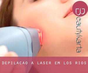 Depilação a laser em Los Ríos