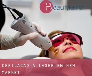 Depilação a laser em New Market