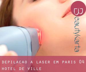 Depilação a laser em Paris 04 Hôtel-de-Ville