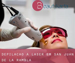 Depilação a laser em San Juan de la Rambla