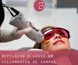 Depilação a laser em Villamartín de Campos