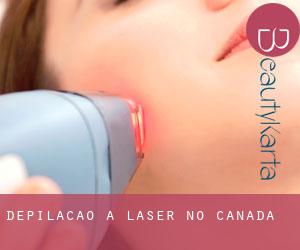 Depilação a laser no Canadá