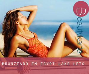 Bronzeado em Egypt Lake-Leto