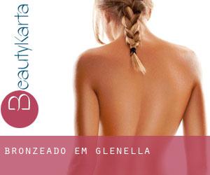 Bronzeado em Glenella Bronzeado em Glenella