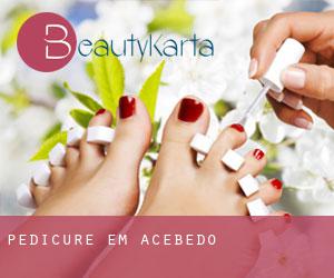 Pedicure em Acebedo