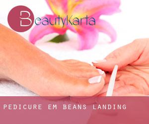 Pedicure em Beans Landing