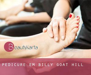 Pedicure em Billy Goat Hill