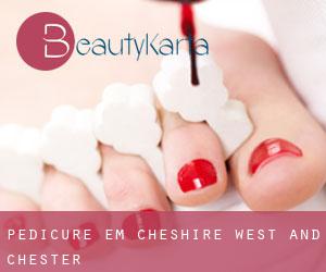 Pedicure em Cheshire West and Chester